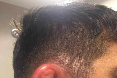 为什么每个人的耳朵都不一样
