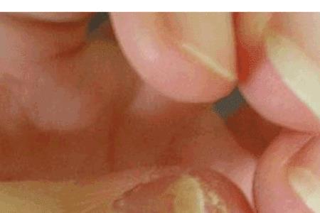 宝宝指甲形状什么时候定型