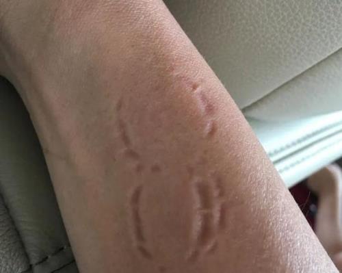 为啥男生突然咬女生的胳膊
