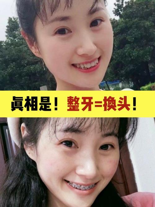说别人没牙是什么意思