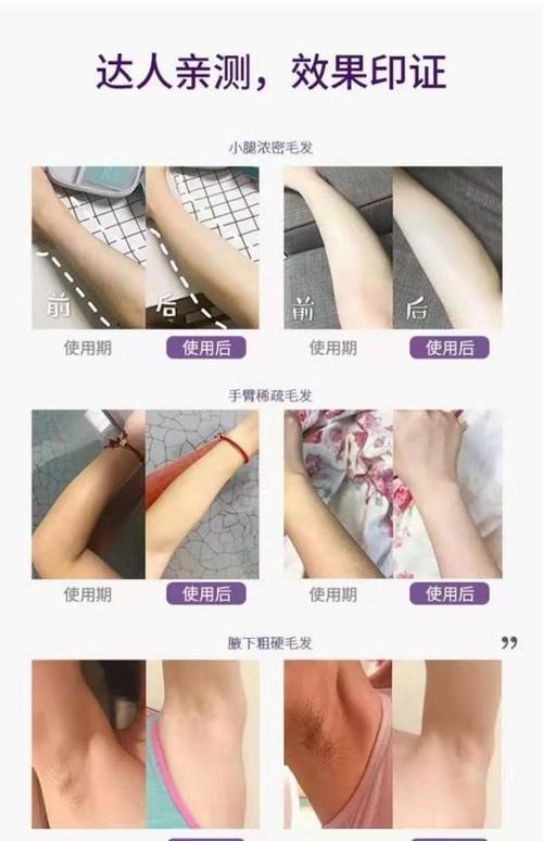 脱毛仪可以敷完面膜再用吗