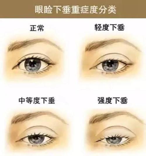 一三一双的眼睛叫什么眼