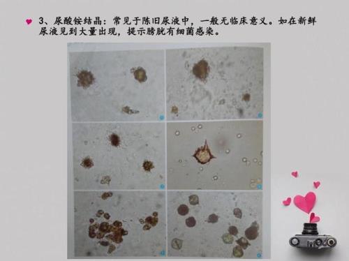 不平衡结晶检验和消除的方法有