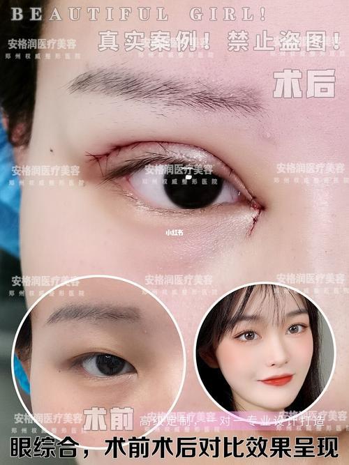 郑州安格润整形医院正规吗