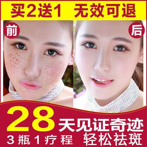 蝴蝶斑怎么遮瑕