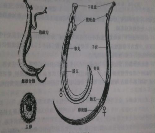 血吸虫是什么虫子