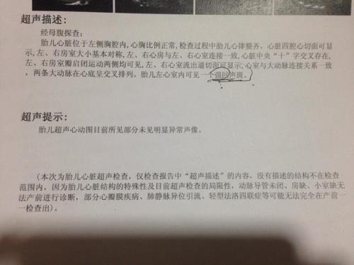 回声反射啥意思