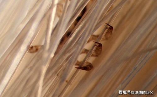 虱子离开人体能活多久