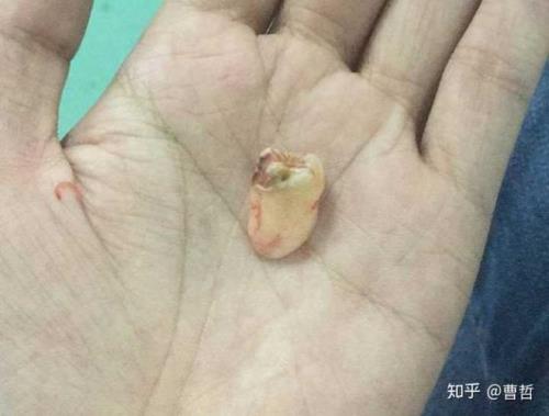 猫咪会长智齿吗
