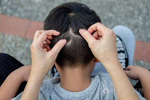 虱子的孩子叫什么