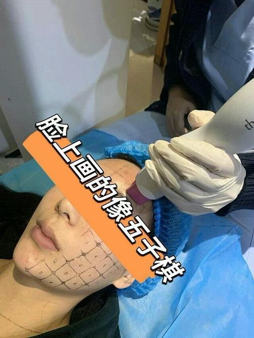 波立塑和超声刀哪个好