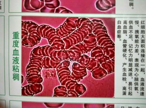 一滴血测出3个样子血糖