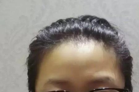 照片宽度不小于1020像素怎么设置