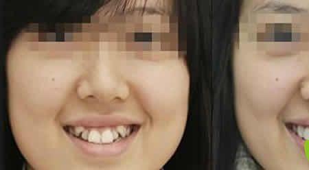 虎牙可以种吗