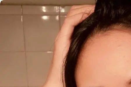 为什么有些人的眉毛会动