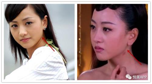 杨蓉长相分析