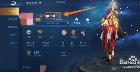 王者荣耀国际服怎么改中文名字