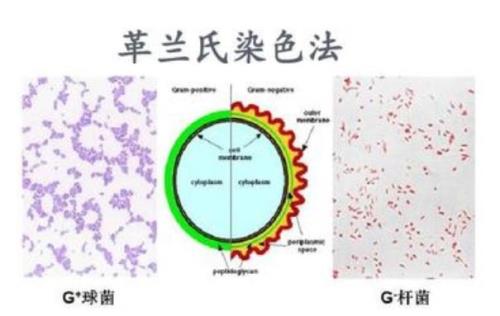 革兰氏染色的关键步骤是什么