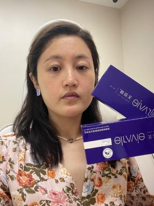 艾莉薇玻尿酸分哪几个型号