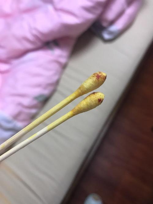 碘伏除掉血渍妙招