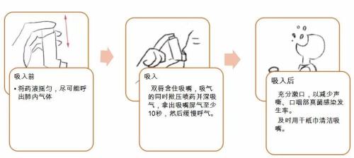 雾化剂是什么