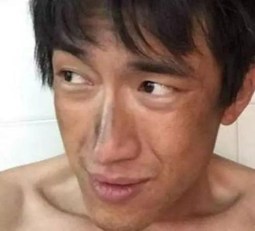 面黄肌瘦是什么意思