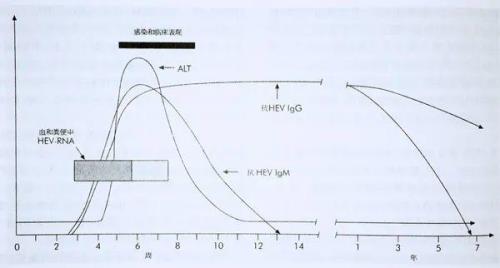 hevigm是什么项目