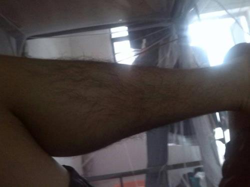 男人腿毛很多代表什么