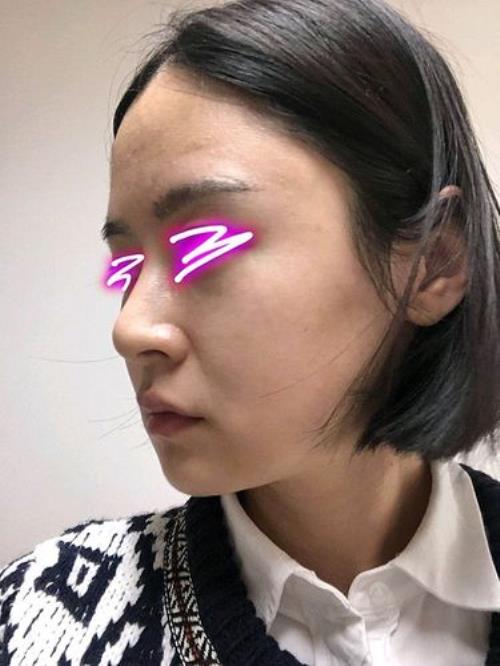 嘟嘟肉用什么填充