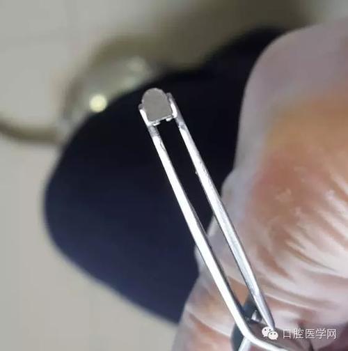 托槽掉了如何自己粘