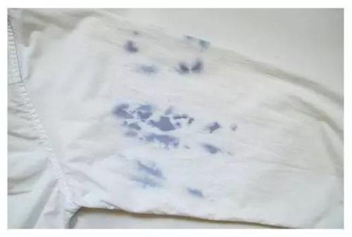 衣服上的霉点要怎么去