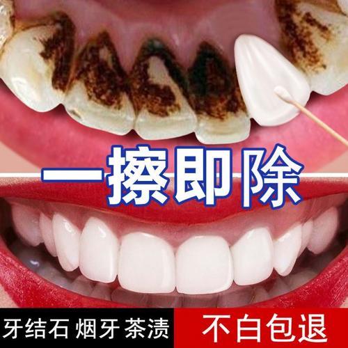牙渍和牙垢怎么去除