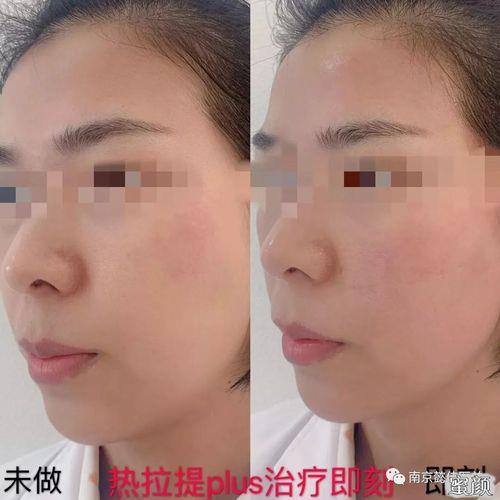 热拉提和m22可以一起做吗