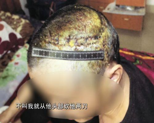 自己能把自己的头砍下来吗