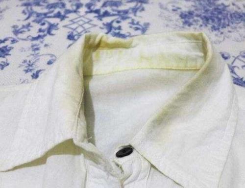 衣服泛黄怎么洗白妙招