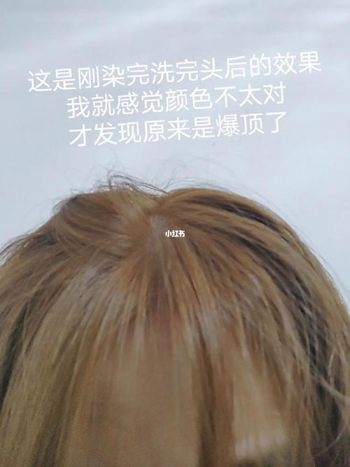 染发爆顶了可以重新染下发尾吗