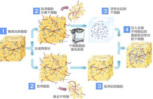 脂肪是细胞膜的主要成分吗