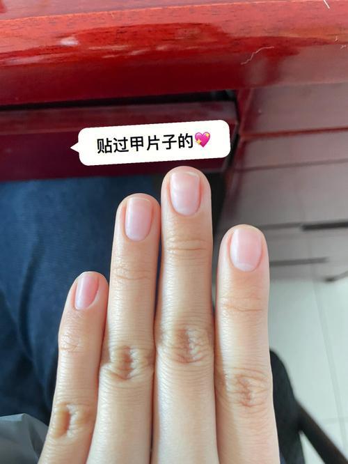 甲片指尖和本甲有缝隙