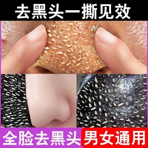 清理黑头粉刺去除的过程