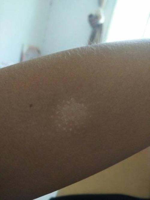 裤子上有些白色的点点怎么洗掉