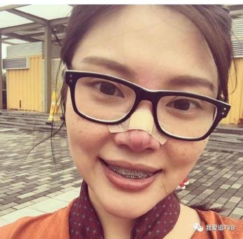 为什么叫大牙妹