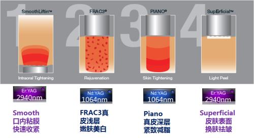 fotona4d效果怎么样