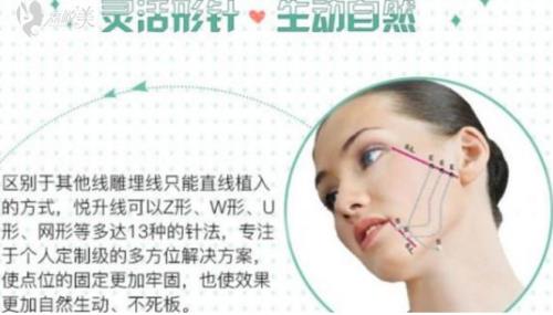 悦升线跟大v线的区别