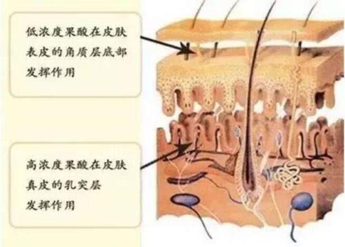 传统钓果酸怎么用