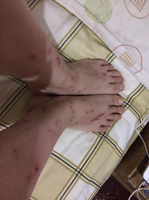 如何彻底清除跳蚤