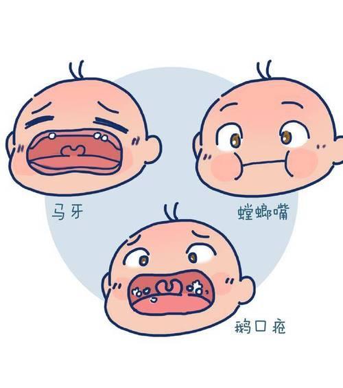 板牙是怎么形成的