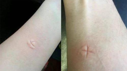 为什么蚊子只咬手