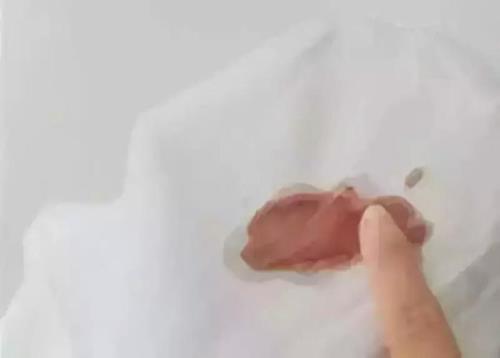 血渍清洗小妙招家用