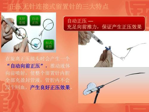留置针为何要左右旋转针芯