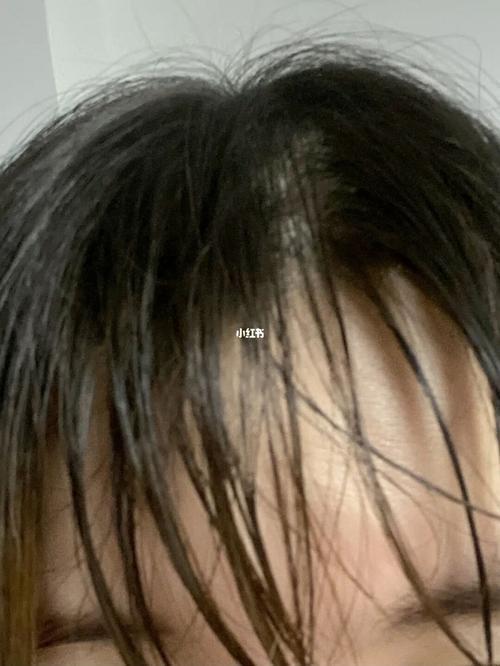 一个月不洗头不洗脸会怎么样
